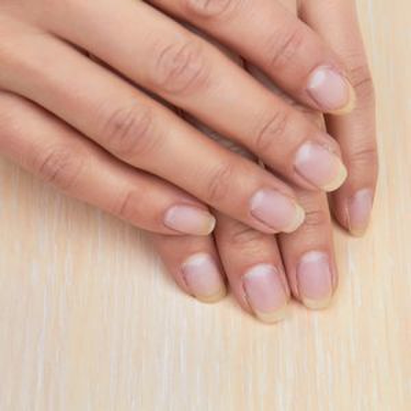 コラム更新 爪の線や凸凹 でこぼこ はなぜできる 爪の症状別の原因とケア方法 Metllasse メトラッセ のブログ Cosme アットコスメ