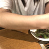 年齢は腕のシワで決まる!いつまでも若くいたい! の画像