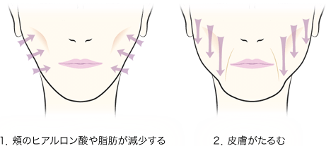 頬が下がり 顔が四角くなった たるみ解決のカギは 朝リフト B Glen ビーグレン のブログ Cosme アットコスメ