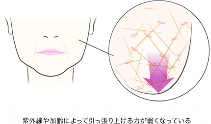 頬が下がり 顔が四角くなった たるみ解決のカギは 朝リフト B Glen ビーグレン のブログ Cosme アットコスメ 頬が下がり 顔が四角くなった たるみ解決のカギは 朝リフト B Glen ビーグレン のブログ Cosme アットコスメ