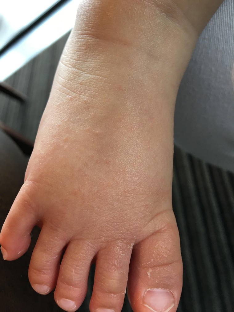 赤ちゃんの肌トラブル 乾燥 汗 アレルギー 大窪 由佳さんのブログ Cosme アットコスメ
