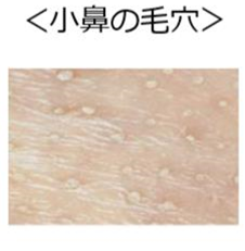 諦めた たるみ毛穴 に もう一度挑もう Reise ライゼ のブログ Cosme アットコスメ 諦めた たるみ毛穴 に もう一度挑もう Reise ライゼ のブログ Cosme アットコスメ