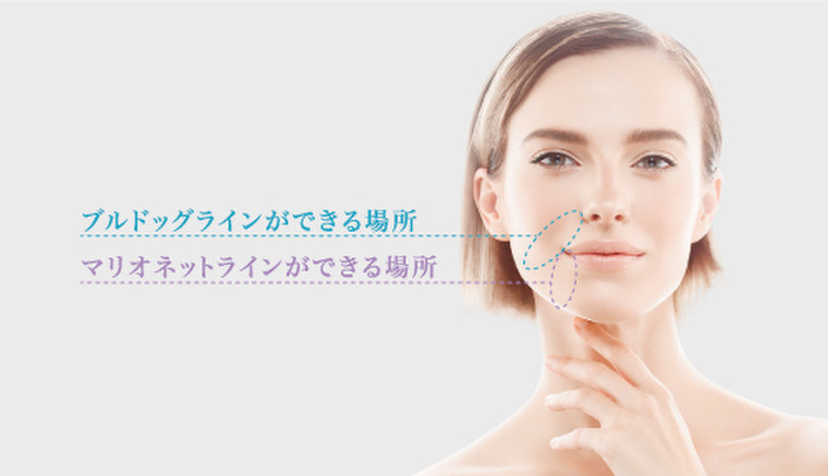 老けた印象を与えない マリオネットラインの対策法とは Mtメタトロンのブログ Cosme アットコスメ 老けた印象を与えない マリオネットラインの対策法とは Mtメタトロンのブログ Cosme アットコスメ