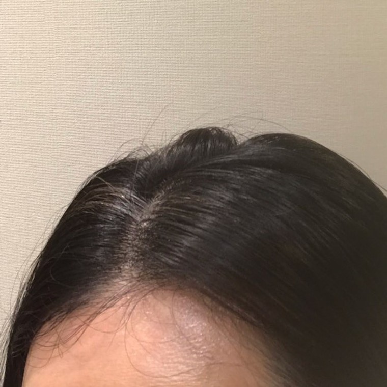 人気だけど今さら聞けない ヘアカラートリートメントって何 大島椿のブログ Cosme アットコスメ