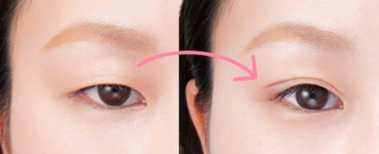 まぶたの運命を変える 感動ふたえコスメ ローヤル化研のブログ Cosme アットコスメ まぶたの運命を変える 感動ふたえコスメ ローヤル化研のブログ Cosme アットコスメ
