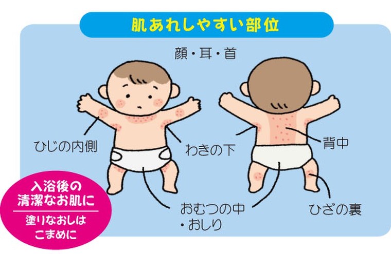 ママさんに 赤ちゃんのスキンケアにはメンタームワセリン メンタームのブログ Cosme アットコスメ ママさんに 赤ちゃんのスキンケアにはメンタームワセリン メンタームのブログ Cosme アットコスメ