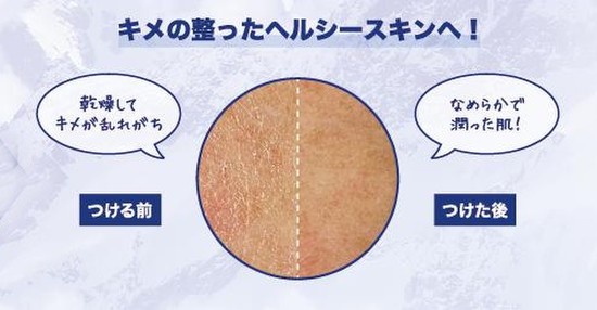 リピに、レフィる？3年連続ベスコス受賞「キールズ クリームUFC