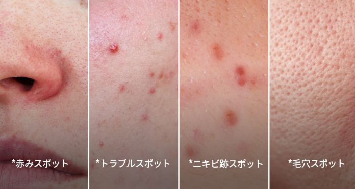 新商品】コスパ最強の美顔器が発売？！大人気のブースタープロの