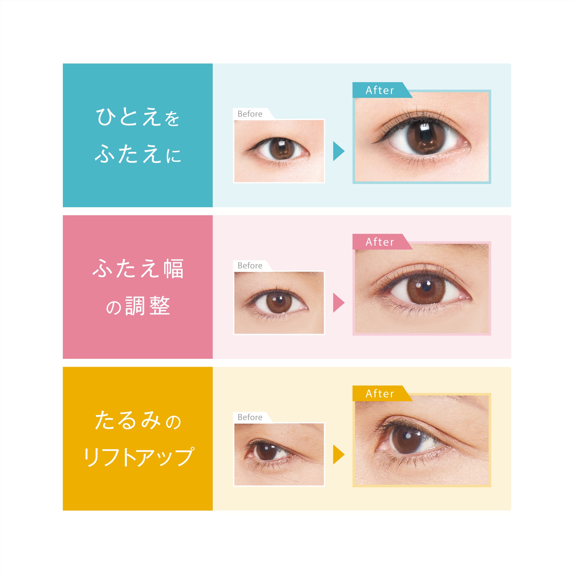 30名様／「バレない×強力皮膜」で、まるで生まれつきのふたえを