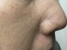 毛穴の角質、汚れについて
