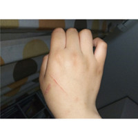 手の傷について 猫 写真を見ていただければわかると思 Q A Cosme アットコスメ 手の傷について 猫 写真を見ていただければわかると思 Q A Cosme アットコスメ