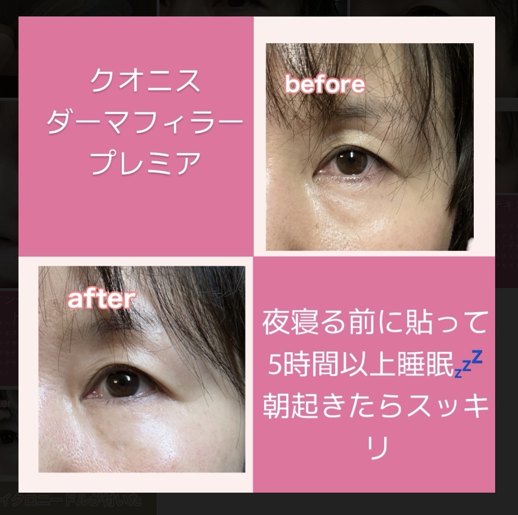 Quanis(クオニス) / ダーマフィラープレミアの公式商品情報
