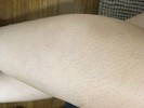 カミソリでのすね毛の処理についてです...