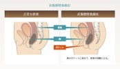 (注)少し汚い話です