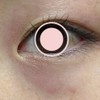 目のクマ　※写真注意