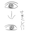 皮膜式で平行二重から末広二重にしたいです