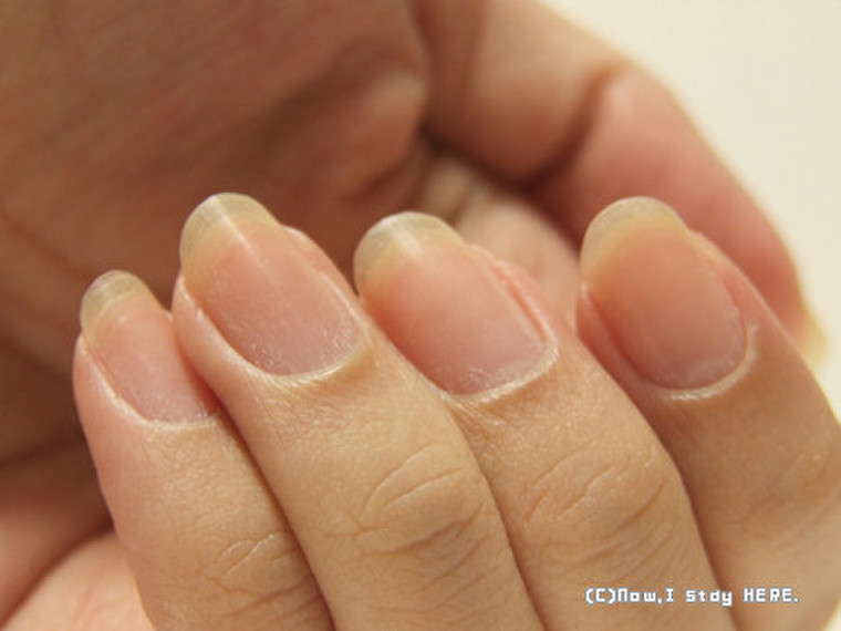 自分の爪を見ながら 來子さんのブログ Cosme アットコスメ