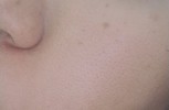 このような肌なのですが、、きれいになるためにはどうしたらいいのでしょうか、、