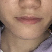 唇 色 赤茶色赤紫どっちよりかな Q A Cosme アットコスメ 唇 色 赤茶色赤紫どっちよりかな Q A Cosme アットコスメ