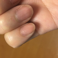 綺麗なセルフネイル 写真のとおり 汚い爪です 甘皮処 Q A Cosme アットコスメ 綺麗なセルフネイル 写真のとおり 汚い爪です 甘皮処 Q A Cosme アットコスメ