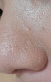 朝からもう毛穴落ちする