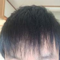 前髪をすかれた タイトル通りなのですが前髪をすかれすぎて Q A Cosme アットコスメ 前髪をすかれた タイトル通りなのですが前髪をすかれすぎて Q A Cosme アットコスメ