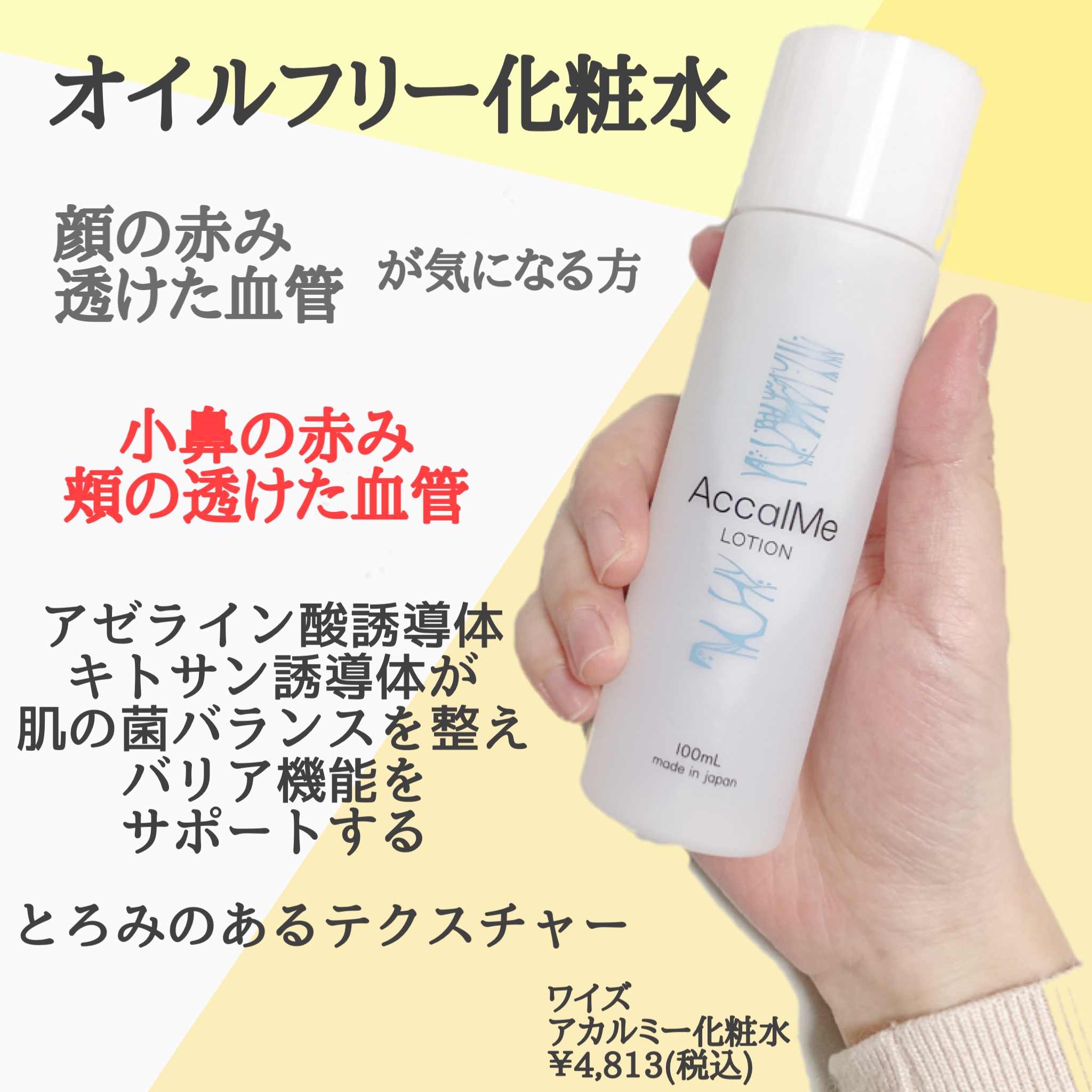 アカルミー化粧水 AccalMe - 基礎化粧品