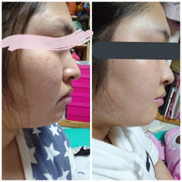 Enisie Glow Packの商品情報 美容 化粧品情報はアットコスメ Enisie Glow Packの商品情報 美容 化粧品情報はアットコスメ