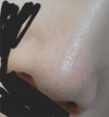 化粧しても毛穴ボコボコ目立つ