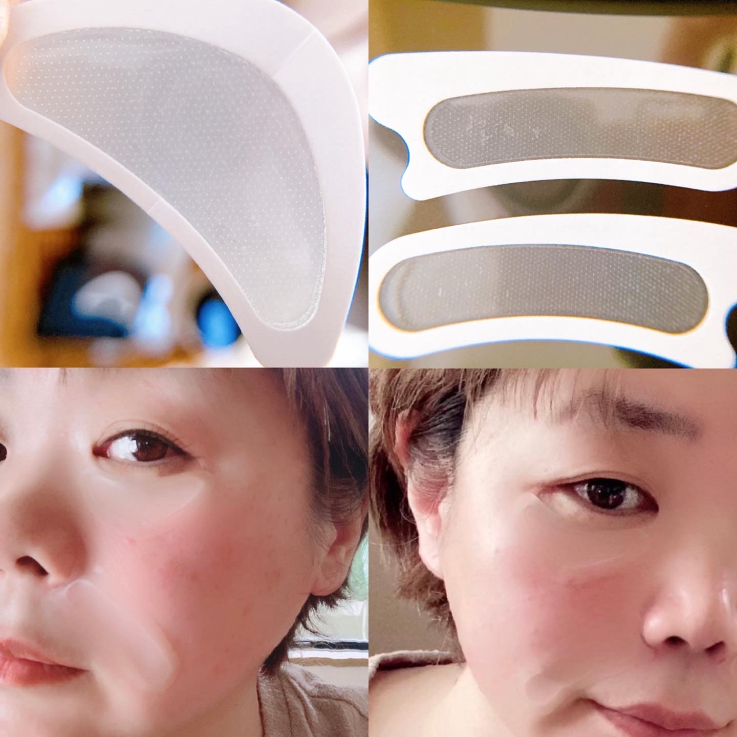 YA-MAN TOKYO JAPAN / メディリフト 3Dマイクロフィラーの口コミ写真（by ☆芽美☆さん 2枚目）｜美容・化粧品情報はアットコスメ
