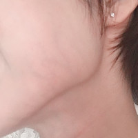 皮膚が薄く血管が透ける 元々アトピーだった事もあり 顔 Q A Cosme アットコスメ 皮膚が薄く血管が透ける 元々アトピーだった事もあり 顔 Q A Cosme アットコスメ