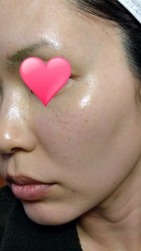 Botanical Peel ボタニカルピーリングパウダー ベースジェルの公式商品情報 美容 化粧品情報はアットコスメ