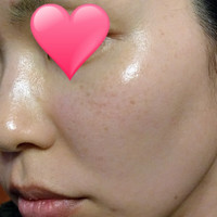 Botanical Peel ボタニカルピーリングパウダー ベースジェルの公式商品情報 美容 化粧品情報はアットコスメ Botanical Peel ボタニカルピーリングパウダー ベースジェルの公式商品情報 美容 化粧品情報はアットコスメ