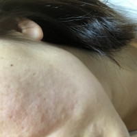 頬の赤み 相談させてください 頬の赤みに悩んでいます Q A Cosme アットコスメ 頬の赤み 相談させてください 頬の赤みに悩んでいます Q A Cosme アットコスメ