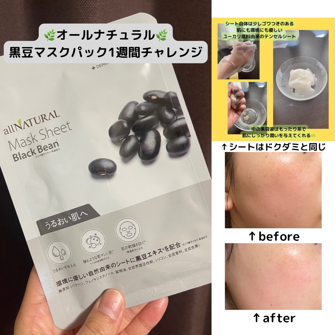 オールナチュラル オールナチュラル マスクパックKM 5枚の公式商品情報｜美容・化粧品情報はアットコスメ