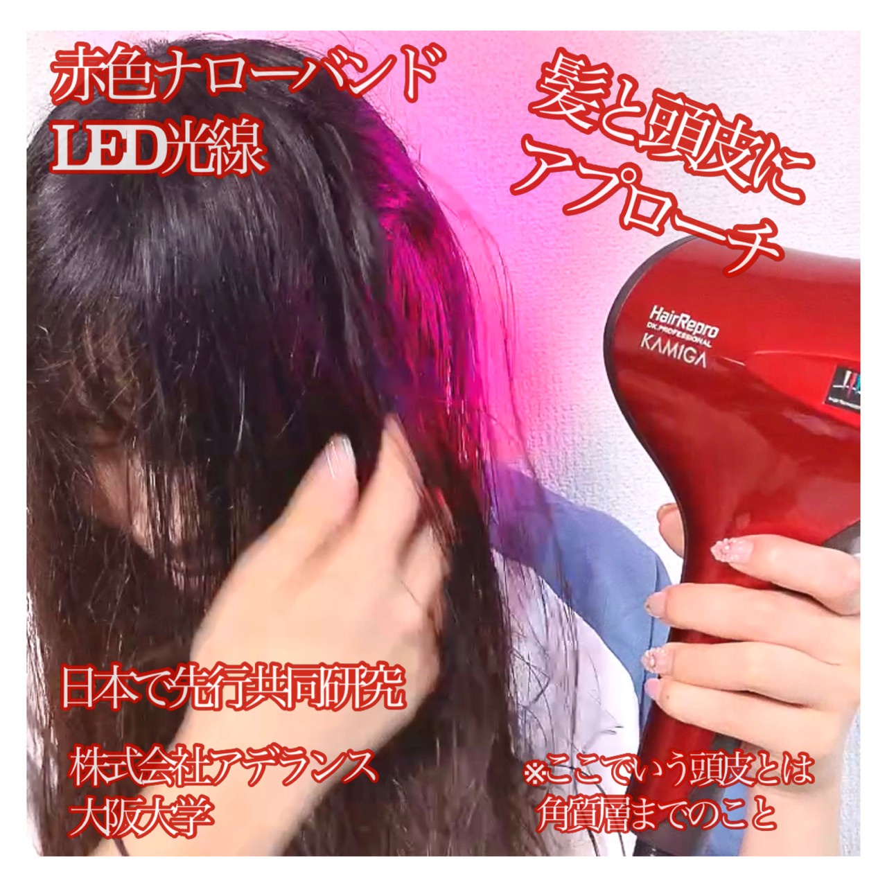 アデランス / N-LED Sonic KAMIGAの口コミ写真（by Kana-cafeさん 2枚