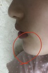 あごについて