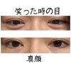 アイクリームについて