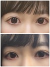 カラコンと裸眼
