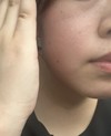 顔と手の色が違う