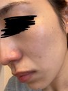 薄いシミ？そばかすを隠すベースメイクアイテムを