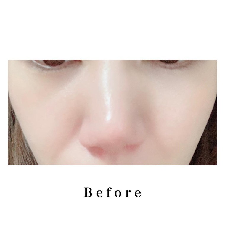 整形級鼻メイク Rinarina さんのブログ Cosme アットコスメ 整形級鼻メイク Rinarina さんのブログ Cosme アットコスメ