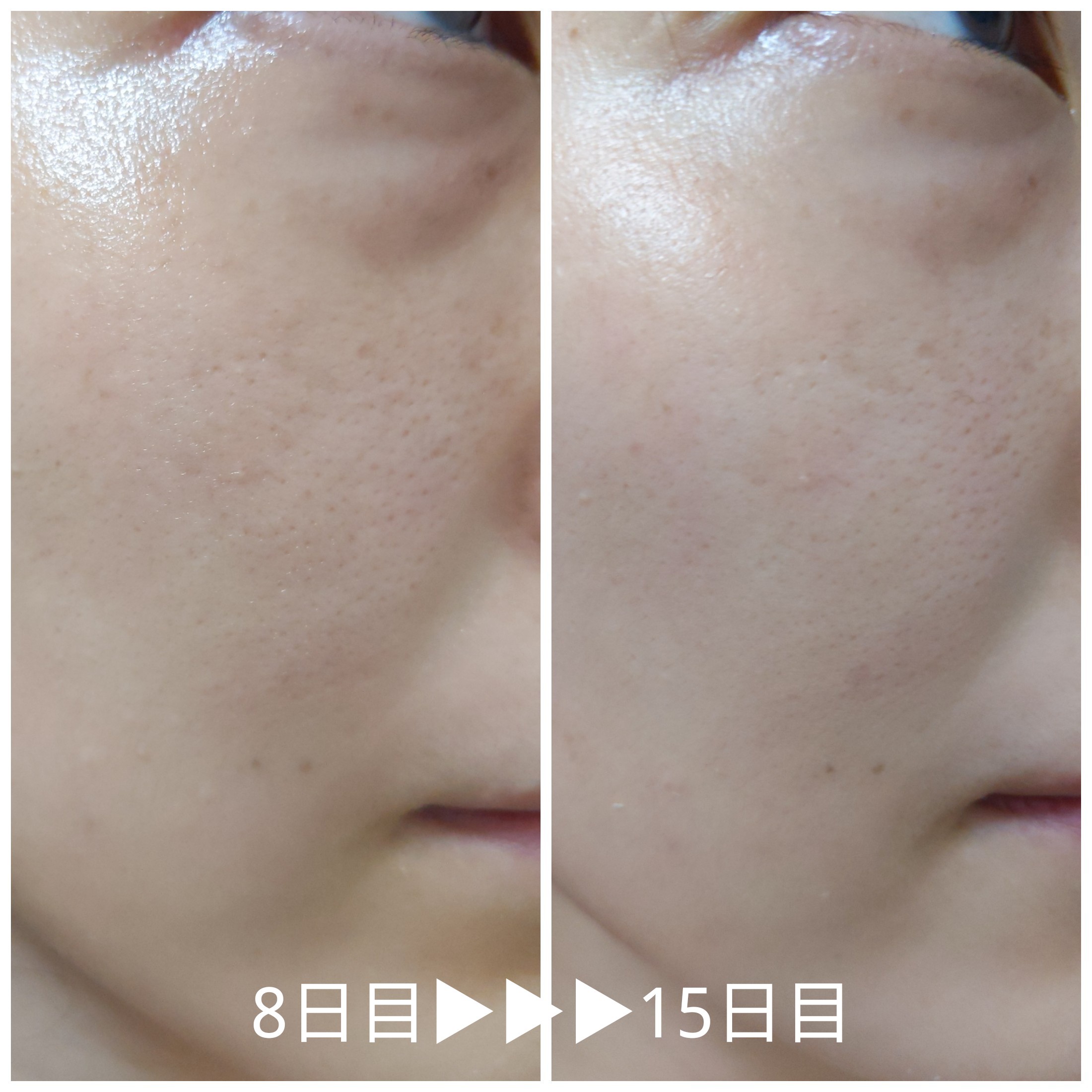 MYCELLUCE（マイセルーチェ） / マイセルーチェ エッセンスの