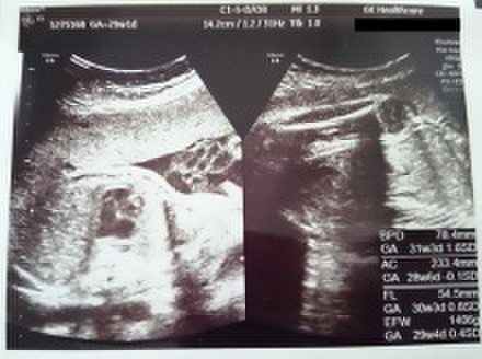 北里大学病院妊婦健診 29w1d 朝子ちゃんさんのブログ Cosme アットコスメ 北里大学病院妊婦健診 29w1d 朝子ちゃんさんのブログ Cosme アットコスメ
