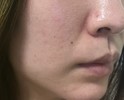 毛穴やごわつきに効くスキンケア