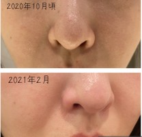 Kiehl S Since 1851 キールズ キールズ Ds クリアリーホワイト ブライトニング エッセンスの口コミ一覧 Like件数の多い順 美容 化粧品情報はアットコスメ Kiehl S Since 1851 キールズ キールズ Ds クリアリーホワイト ブライトニング エッセンスの口コミ一覧 Like件数の多い順 美容 化粧品情報はアットコスメ