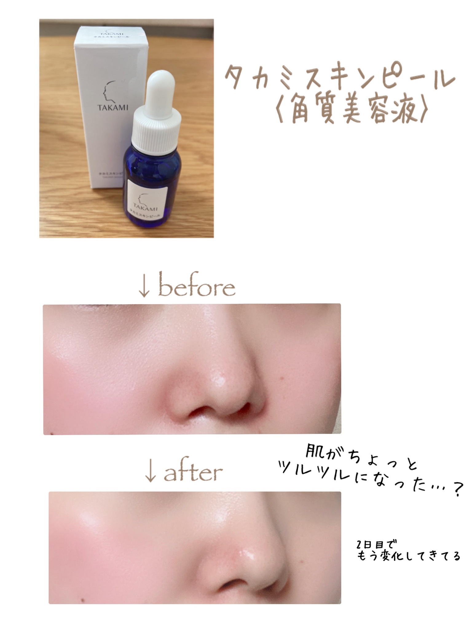 タカミスキンピール タカミ スキンピール 30ml - クレンジング・メイク ...