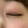 目頭のシワ？を無くしたいです…