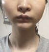 顔の歪みについて