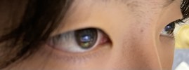 重い一重なのか、薄い一重なのか教えてください！！二重になるのかどうかなど